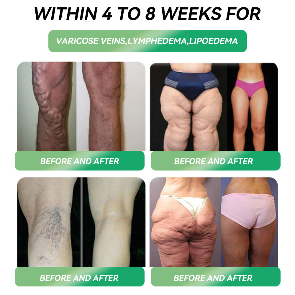 Only 10 boxes left! ⚡⚡ HHVB® offering an extra 30% off for you! Doctor-tested and proven, 4-6 boxes of our patches are enough to help you manage your weight and blood sugar levels with long-lasting results. Grab yours now!