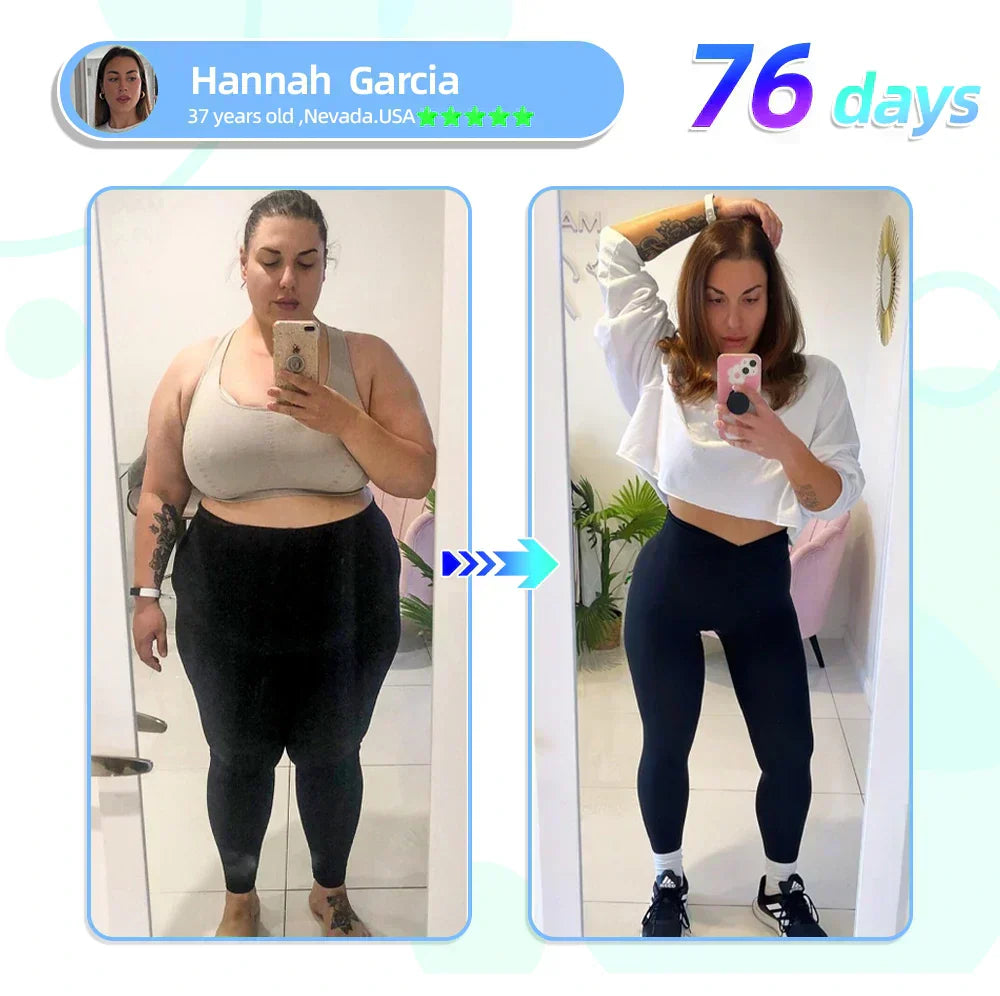 【𝙇𝙖𝙨𝙩 𝘿𝙖𝙮 𝙋𝙧𝙤𝙢𝙤𝙩𝙞𝙤𝙣 70% 𝙊𝙁𝙁👨‍⚕️👨‍⚕️】𝐇𝑯𝑽𝐁® 𝙏𝙞𝙧𝙯𝙚𝙥𝙖𝙩𝙞𝙙𝙚 𝙉𝙖𝙣𝙤 𝙈𝙞𝙘𝙧𝙤𝙣𝙚𝙚𝙙𝙡𝙚 𝙋𝙖𝙩𝙘𝙝 👨‍⚕️（𝙕𝙚𝙧𝙤 𝙋𝙖𝙞𝙣, 24/7 𝙍𝙚𝙡𝙚𝙖𝙨𝙚 | 𝙇𝙤𝙨𝙚 𝟏𝟎 𝐤𝐠 𝙁𝘼𝙎𝙏 | 90% 𝙎𝙪𝙜𝙖𝙧 𝘿𝙧𝙤𝙥 | ）
